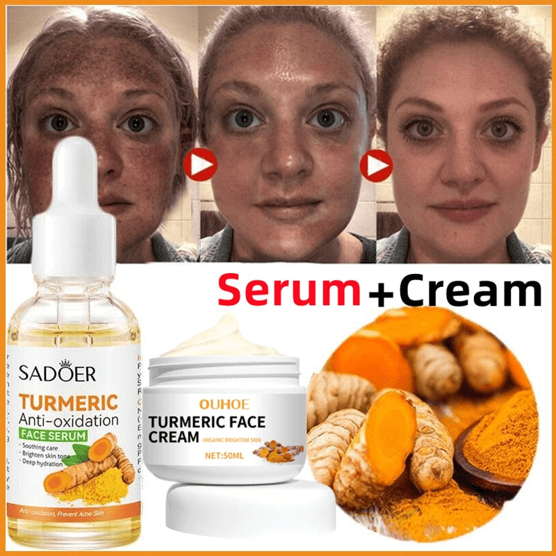Turmeric - Fade Serum - Whitening Serum - Skin Care - Skin Product - Skin Corrector - Bossed Up Fashion